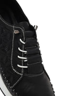 Women's Black Thick-Soled Patterned Leather Comfort Shoes | Derimod